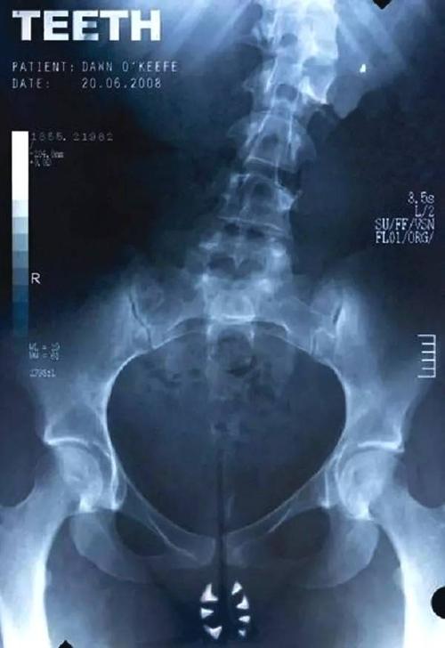 托福成绩单丢失怎么办